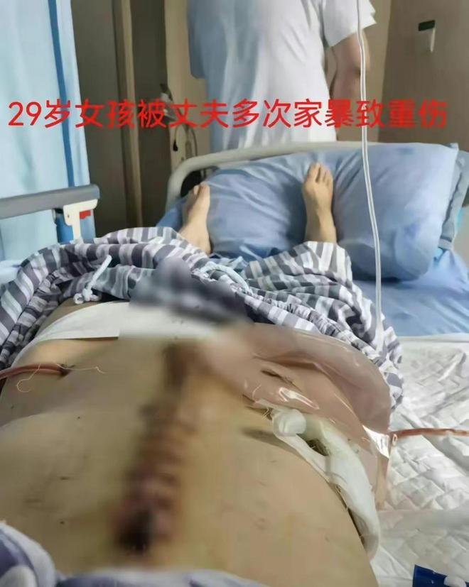 女子遭家暴十六次，呼吁法律严惩施暴者，死刑是否合适？全面指南与深度解析_有问必答